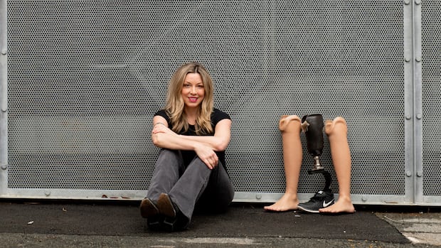 woman-taught-devastating-lesson-in-job-safety-uses-e-learning-to-spread-message-to-young-|-cbc-news