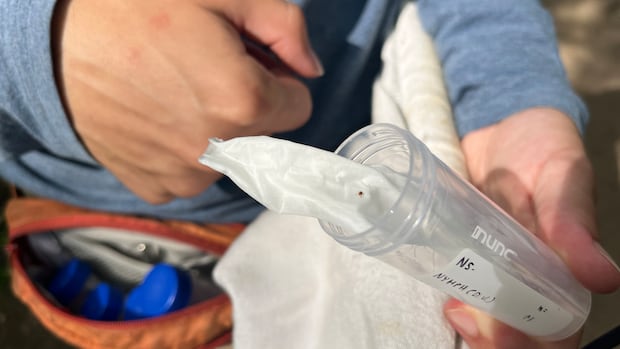 voices-in-the-wilderness:-the-rise-of-tick-research-in-the-maritimes-|-cbc-news